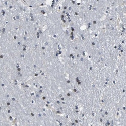 SNX10 Antibody, Novus Biologicals 0.1mL; Unlabeled:Antistoffer